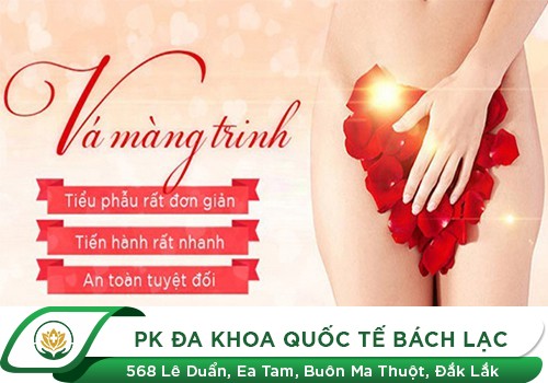 May Màng Trinh Là Gì