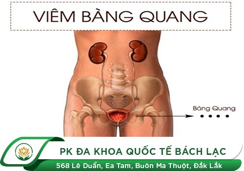 Nguyên Nhân Và Nguy Hại Của Bệnh Viêm Bàng Quang Đến Sức Khỏe Nữ Giới
