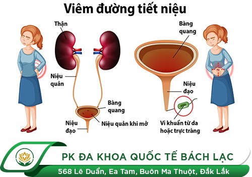 Dấu hiệu viêm đường tiết niệu ở nữ giới