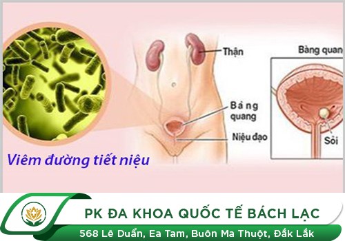 Triệu Chứng Nhận Biết Nhiễm Trùng Đường Tiểu Ở Nữ Giới