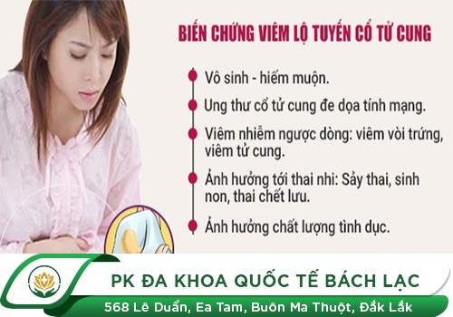 Cách Chữa Trị Bệnh Viêm Lộ Tuyến Cổ Tử Cung Hiệu Quả
