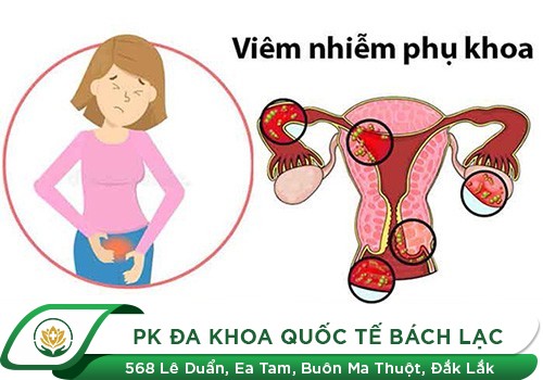 Những Căn Bệnh Phụ Khoa Phổ Biến Nhất Hiện Nay