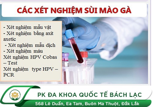 Chi Phí Xét Nghiệm Sùi Mào Gà