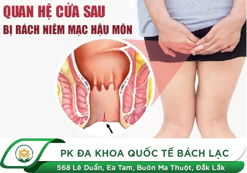 Quan hệ cửa sau bị rách hậu môn phải làm sao?