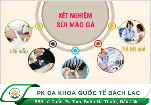 Quy Trình Khám Sùi Mào Gà Như Thế Nào?