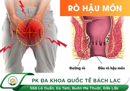 Các Dạng Rò Hậu Môn Và Cách Hỗ Trợ Điều Trị Hiện Nay