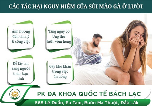 Bạn Đã Biết Gì Về Bệnh Sùi Mào Gà Ở Lưỡi