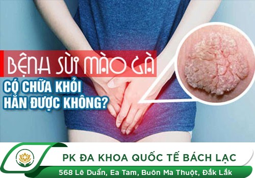 Bệnh Sùi Mào Gà Có Tự Hết Không