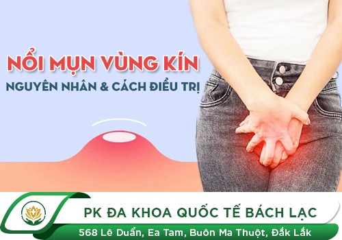 Mụn ở cô bé là triệu chứng của bệnh gì?