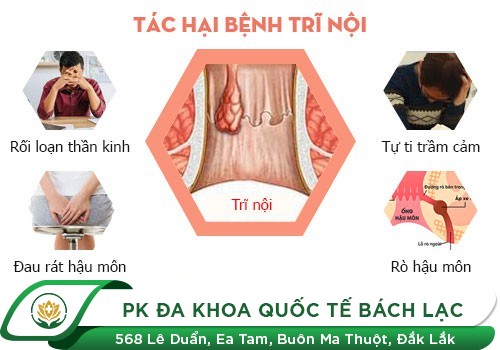 Bệnh trĩ nội