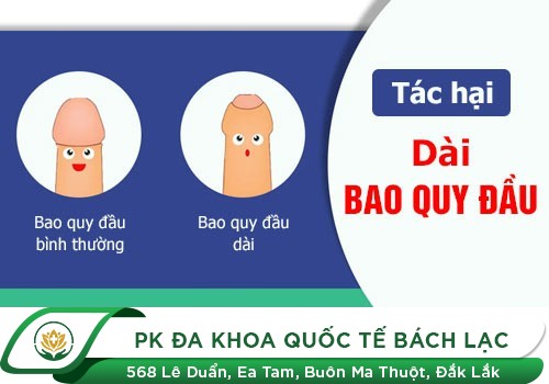 Dài Bao Quy Đầu Có Quan Hệ Được Không?
