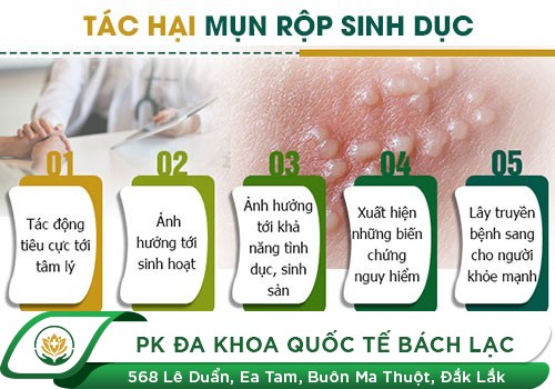 Tổng Quan Về Bệnh Mụn Rộp Sinh Dục. Cách Điều Trị Và Địa Chỉ Trị Mụn Rộp Sinh Dục Hiệu Quả