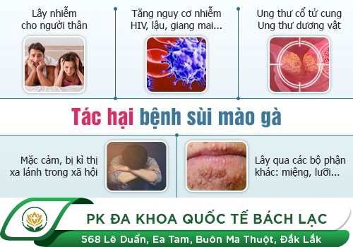 Sùi Mào Gà Ở Nam Giới Nguy Hiểm Thế Nào?