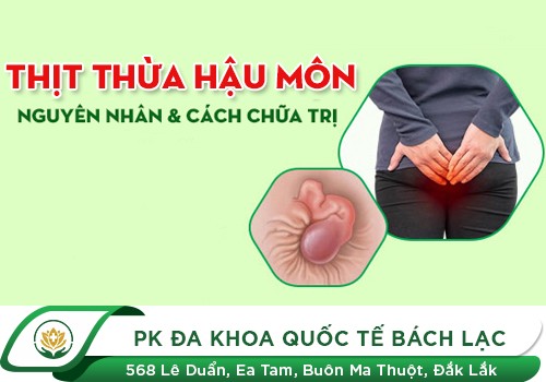 Cắt thịt thừa hậu môn ở đâu tốt nhất?