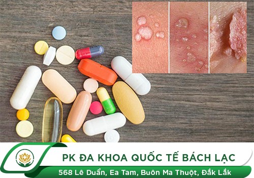 Thuốc Đặc Trị Chữa Sùi Mào Gà