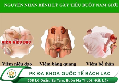 Bệnh Tiểu Buốt, Tiểu Rắt Ở Nam Và Nữ