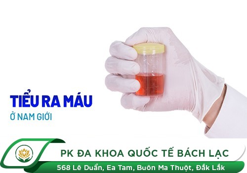 Cảnh báo tình trạng tiểu ra máu ở nam giới