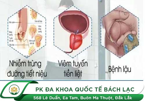 Tiểu Rắt Ở Nam Giới - Tôi Bị Mắc Bệnh Gì