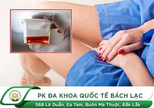 Đái ra máu ở nữ giới - cảnh báo bệnh nguy hiểm