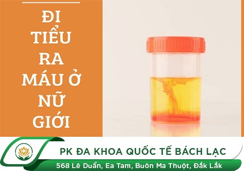 Đi tiểu ra nước màu hồng nhạt là bệnh gì?