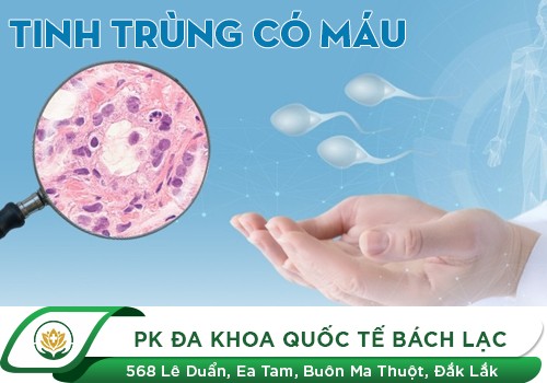 Tinh trùng có máu đỏ là do những nguyên nhân nào?