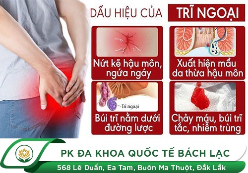 Dấu Hiệu Cảnh Báo Bệnh Trĩ Ngoại