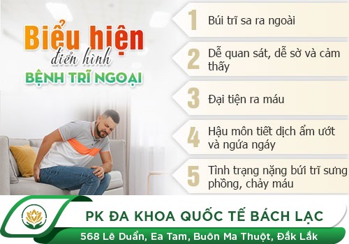 Triệu Chứng Của Bệnh Trĩ Ngoại