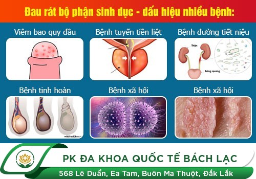 Cảnh Giác Hiện Tượng Nóng Rát Đầu Dương Vật