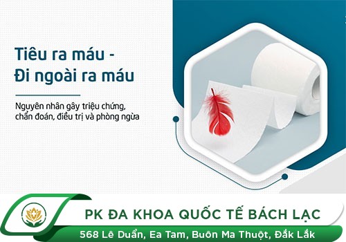 Đi Ỉa Ra Máu Không Nên Chủ Quan