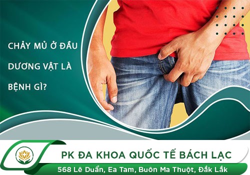 Chảy Mủ Ở Bộ Phận Sinh Dục Nam, Chớ Coi Thường