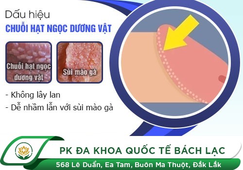 Hình Ảnh Chuỗi Hạt Ngọc Dương Vật Ở Nam Giới