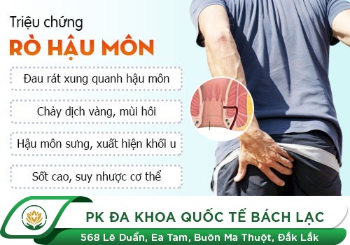 Triệu Chứng Rò Hậu Môn Phổ Biến Nhất Ai Cũng Cần Biết