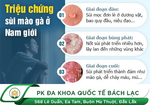 Mọc Mụn Thịt Ở Bộ Phận Sinh Dục Nam Có Ảnh Hưởng Gì Không