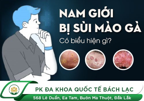 Dấu Hiệu Sùi Mào Gà Ở Nam Giới