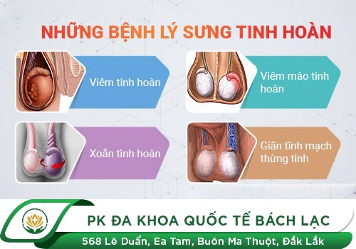 Tinh hoàn bị sưng to và cách chữa