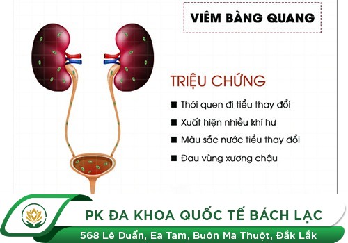 7 Dấu Hiệu Bạn Phải Đi Khám Bàng Quang Trước Khi Quá Muộn