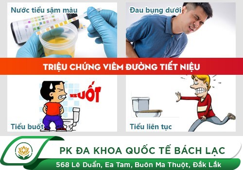 Triệu Chứng Viêm Đường Tiết Niệu Lưu Ý