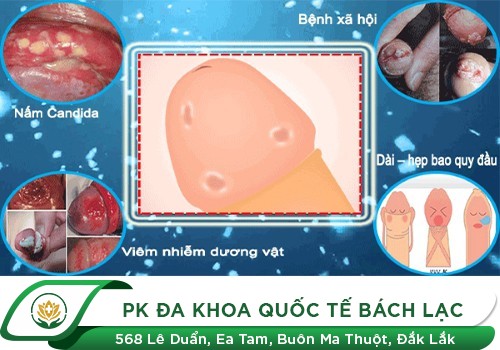 Dương Vật Bị Tróc Da Ngứa Là Dấu Hiệu Bệnh Gì?
