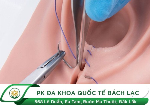 Địa Chỉ Vá Màng Trinh Uy Tín, Chất Lượng Tại Đắk Lắk