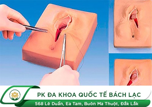 Những Hệ Lụy Khi Chị Em Sử Dụng Màng Trinh Giả