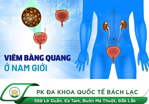 Đau Tức Bàng Quang, Có Phải Do Bệnh Viêm Bàng Quang Không