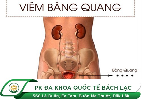 Bị Viêm Bàng Quang Có Quan Hệ Được Không