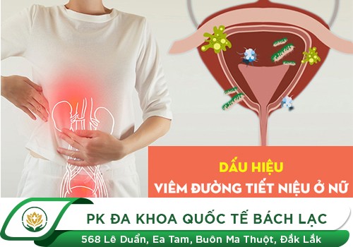 Dấu hiệu nhận biết viêm đường tiết niệu ở nữ