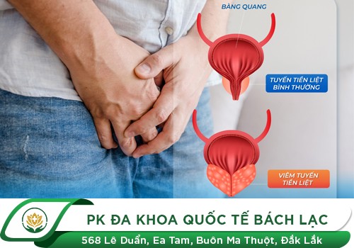 Các phương pháp điều trị viêm tuyến tiền liệt