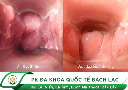 Quan Hệ Bị Chảy Máu - Nguy Hiểm Chớ Coi Thường