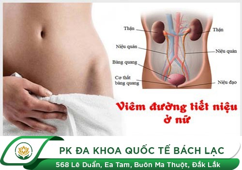 Tổng quan về bệnh viêm đường tiết niệu
