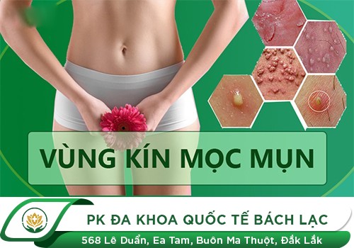 Âm Đạo Mụn Ngứa Là Dấu Hiệu Bệnh Gì?