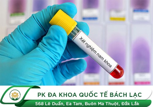 Xét nghiệm nam khoa tổng quát