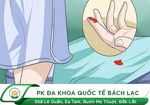 Viêm vùng chậu và những dấu hiệu tố cáo căn bệnh